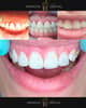 Slider image (6) Improve Dental